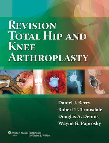 Cover image for Revision Total Hip and Knee Arthroplasty