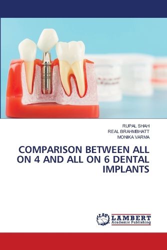 Cover image for Comparison Between All on 4 and All on 6 Dental Implants