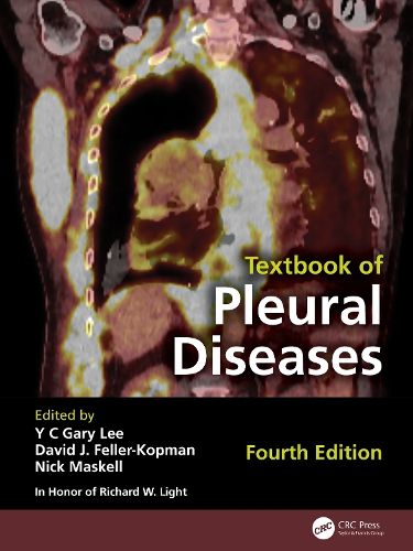 Cover image for Textbook of Pleural Diseases