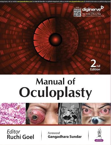 Cover image for Manual of Oculoplasty