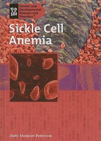 Cover image for Sickle Cell Anemia