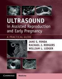 Cover image for Ultrasound in Assisted Reproduction and Early Pregnancy: A Practical Guide