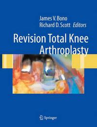 Cover image for Revision Total Knee Arthroplasty