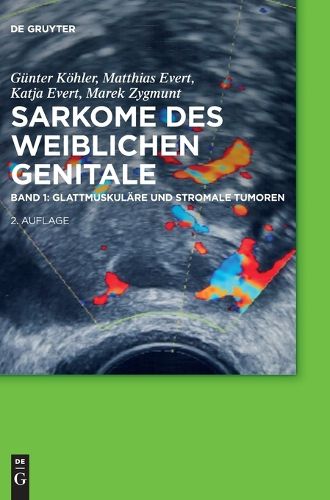 Cover image for Glattmuskulare Und Stromale Tumoren