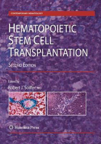 Cover image for Hematopoietic Stem Cell Transplantation