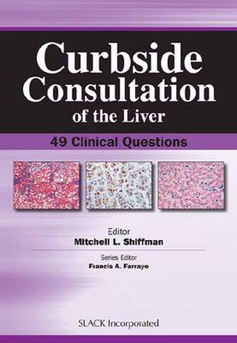 Cover image for Curbside Consultation of the Liver: 49 Clinical Questions