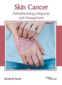 Cover image for Skin Cancer: Pathophysiology, Diagnosis and Management