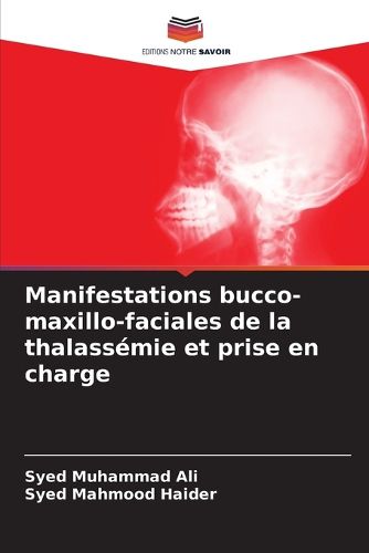 Cover image for Manifestations bucco-maxillo-faciales de la thalassemie et prise en charge