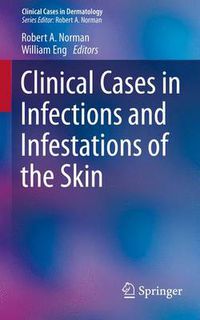 Cover image for Clinical Cases in Infections and Infestations of the Skin