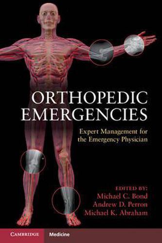 Cover image for Orthopedic Emergencies: Expert Management for the Emergency Physician