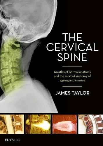 Cover image for The Cervical Spine: An atlas of normal anatomy and the morbid anatomy of ageing and injuries