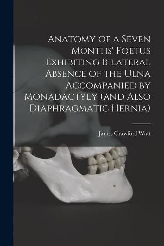 Cover image for Anatomy of a Seven Months' Foetus Exhibiting Bilateral Absence of the Ulna Accompanied by Monadactyly (and Also Diaphragmatic Hernia) [microform]