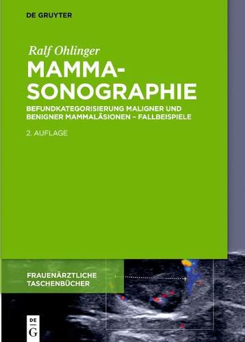 Cover image for Mammasonographie