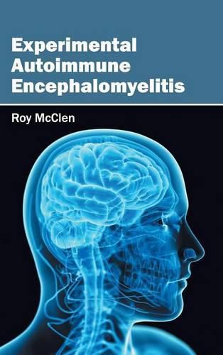 Cover image for Experimental Autoimmune Encephalomyelitis