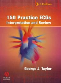 Cover image for 150 Practice ECGs: Interpretation and Review