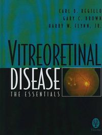 Cover image for Vitreoretinal Disease: The Essentials