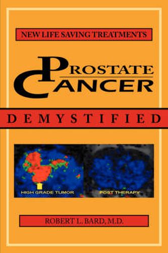 Prostate Cancer Demystified