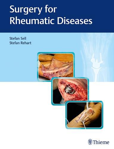 Cover image for Surgery for Rheumatic Diseases