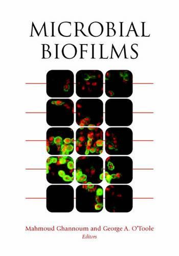 Cover image for Microbial Biofilms