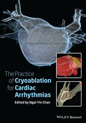 Cover image for The Practice of Catheter Cryoablation for Cardiac Arrhythmias