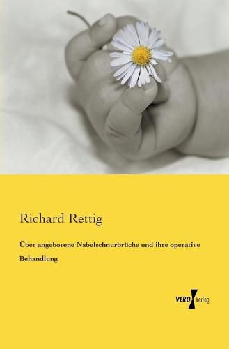 Cover image for UEber angeborene Nabelschnurbruche und ihre operative Behandlung