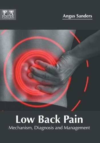 Cover image for Low Back Pain: Mechanism, Diagnosis and Management