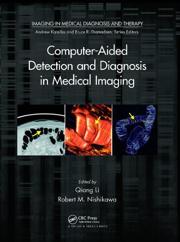 Cover image for Computer-Aided Detection and Diagnosis in Medical Imaging