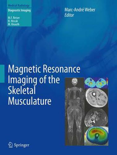 Cover image for Magnetic Resonance Imaging of the Skeletal Musculature