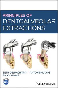 Cover image for Principles of Dentoalveolar Extractions