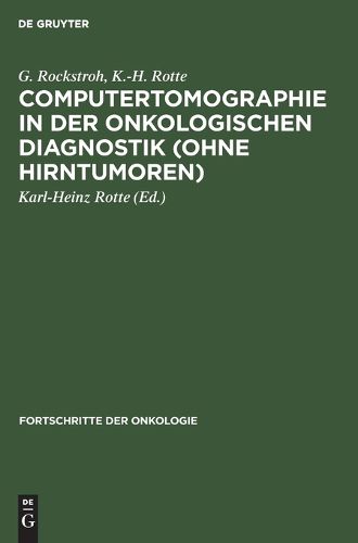 Cover image for Computertomographie in der onkologischen Diagnostik (ohne Hirntumoren)