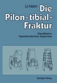 Cover image for Die Pilon-tibial-Fraktur