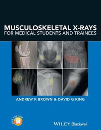 Cover image for Musculoskeletal X-rays for Medical Students