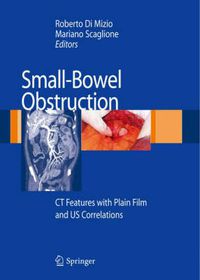 Cover image for Small-Bowel Obstruction: CT Features with Plain Film and US correlations