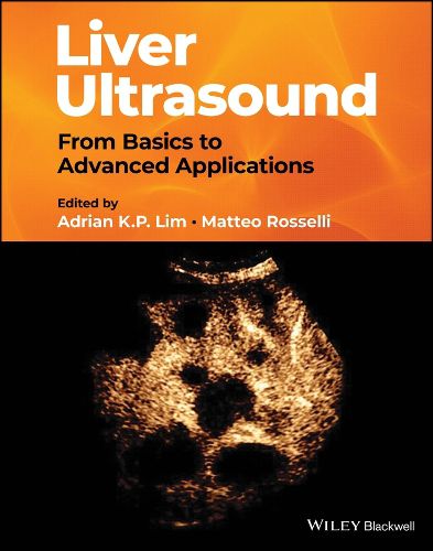 Cover image for Liver Ultrasound: From Basics to Advanced Applicat ions