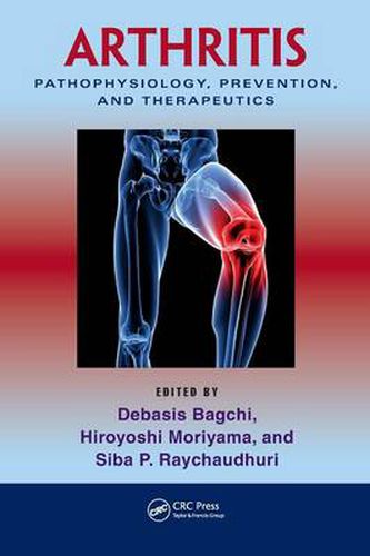 Cover image for Arthritis: Pathophysiology, Prevention, and Therapeutics