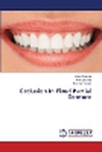 Cover image for Occlusion In Fixed Partial Denture