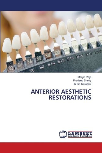 Cover image for Anterior Aesthetic Restorations