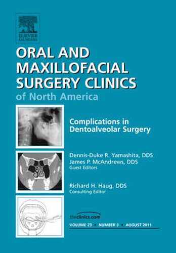 Cover image for Complications in Dento-Alveolar Surgery, An Issue of Oral and Maxillofacial Surgery Clinics