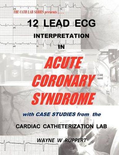 Cover image for 12 Lead ECG Interpretation in Acute Coronary Syndrome with Case Studies from the Cardiac Catheterization Lab