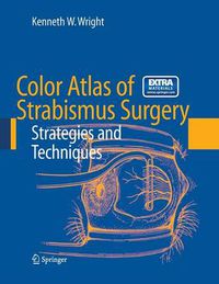 Cover image for Color Atlas of Strabismus Surgery: Strategies and Techniques