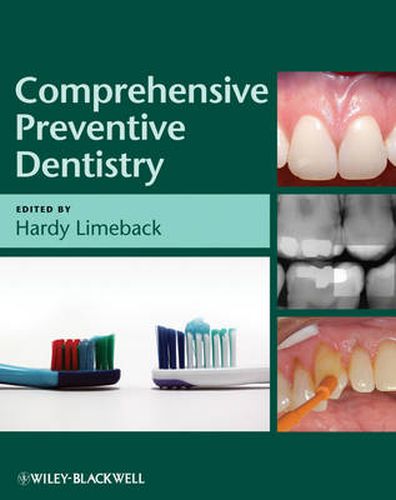 Cover image for Comprehensive Preventive Dentistry