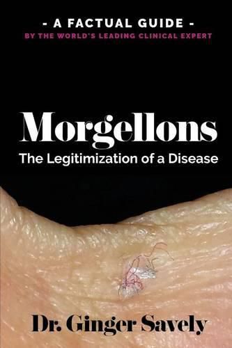 Cover image for Morgellons: The legitimization of a disease: A Factual Guide by the World's Leading Clinical Expert