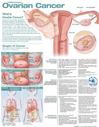 Cover image for Understanding Ovarian Cancer Anatomical Chart