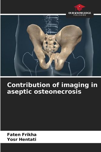 Cover image for Contribution of imaging in aseptic osteonecrosis
