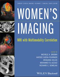 Cover image for Women's Imaging: MRI with Multimodality Correlation