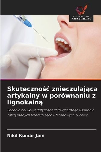 Cover image for Skutecznośc znieczulająca artykainy w porownaniu z lignokainą