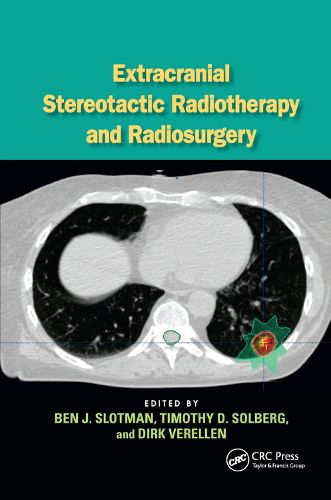 Cover image for Extracranial Stereotactic Radiotherapy and Radiosurgery