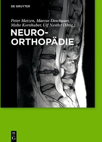 Cover image for Neuroorthopadie