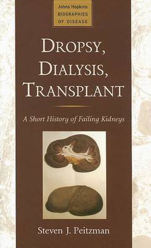 Cover image for Dropsy, Dialysis, Transplant: A Short History of Failing Kidneys