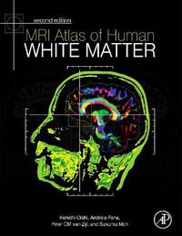 Cover image for MRI Atlas of Human White Matter